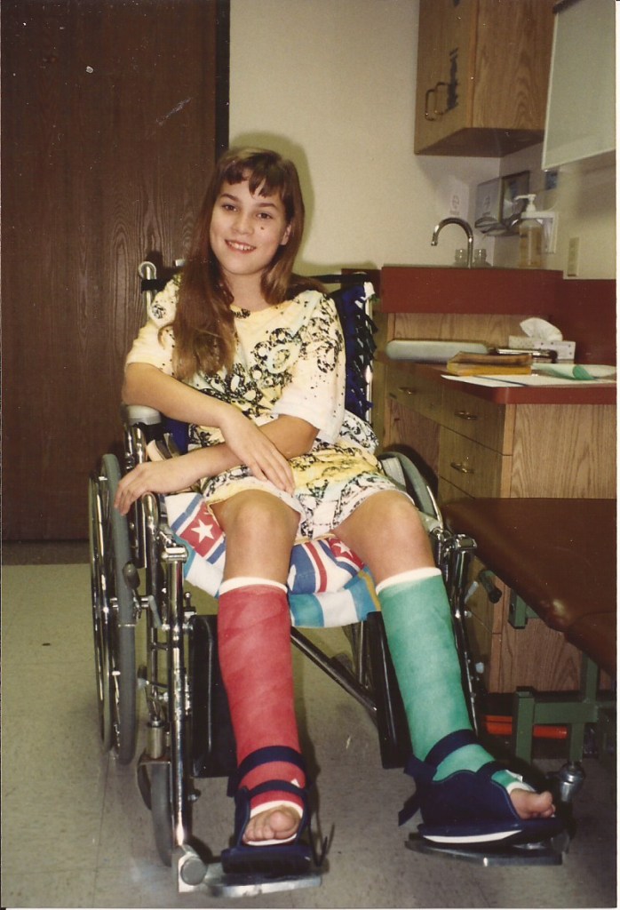 In a wheelchair after getting new casts. After surgery for cerebral palsy.